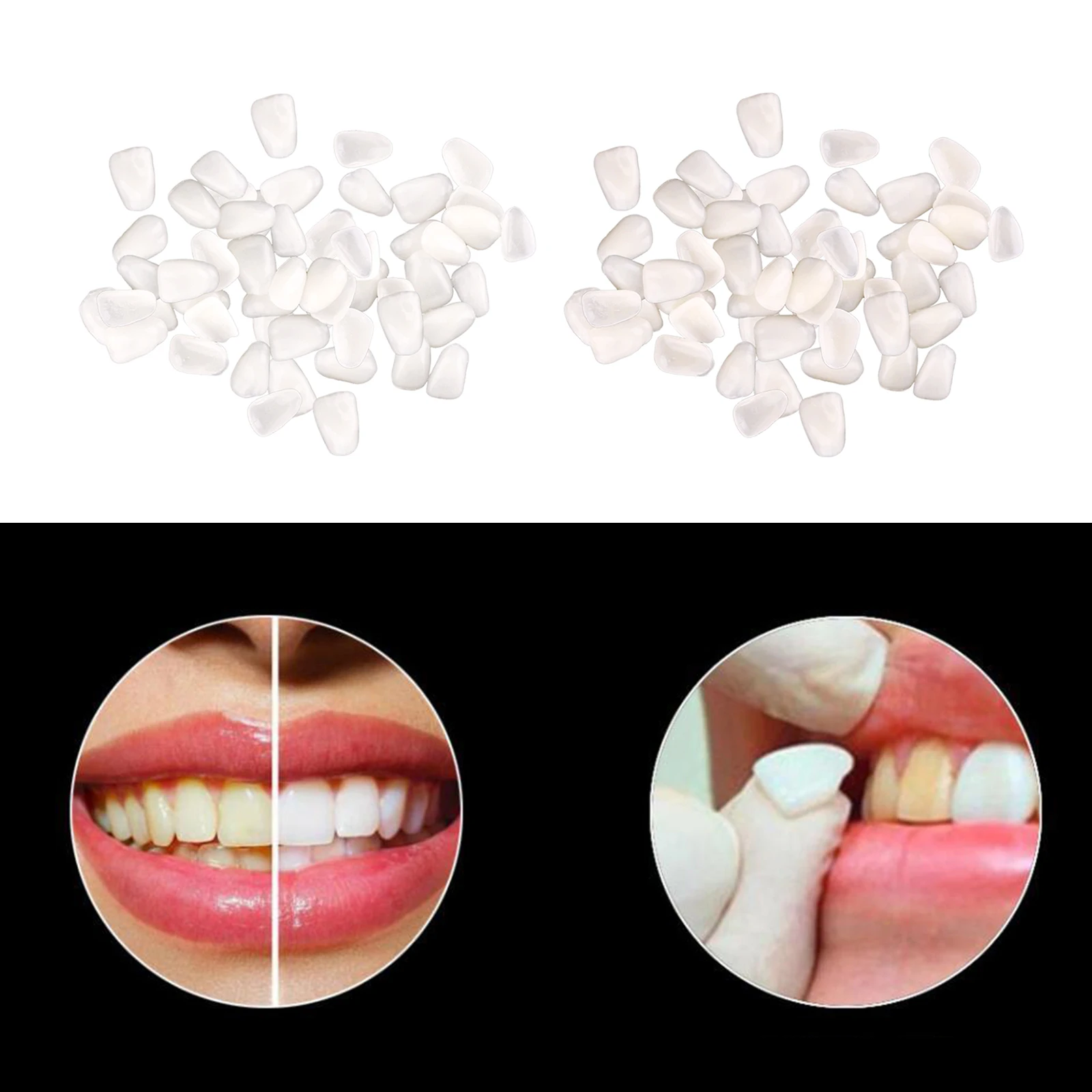 

Ultra-Thin Teeth Temporary Veneers Anterior Resin Whitening Mixed Type