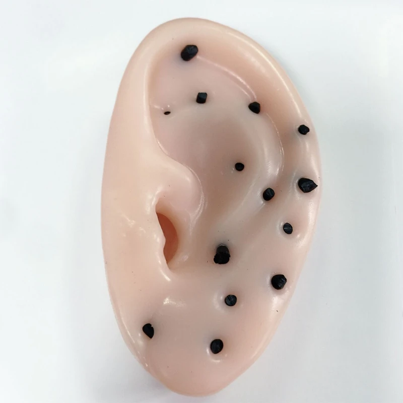 

Pimple Popper Toy Ear Shape Pimple Popping Decompression Acne Blackheads Remover 97BE