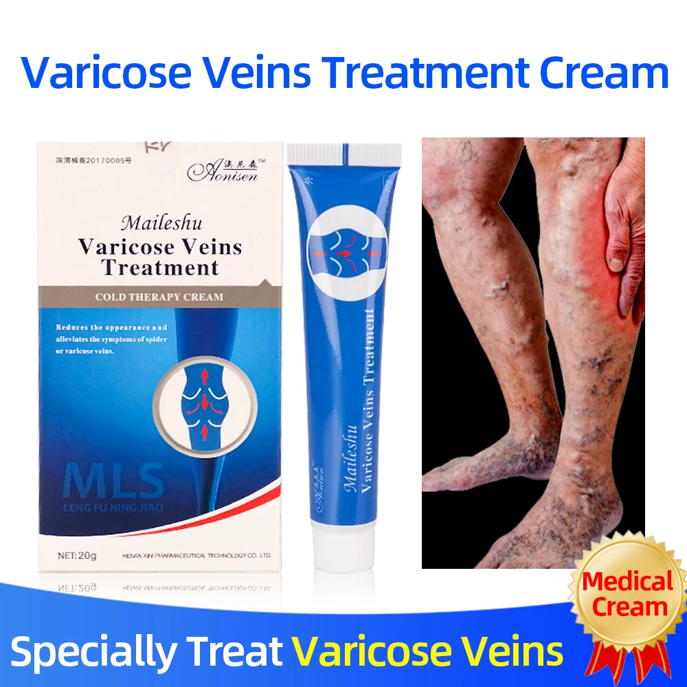 

Varicose veins Treatment Cold Compress Cream Treatment Varicose Vasculitis Phlebitis Spider Legs Veins Pain Health Care Plaster