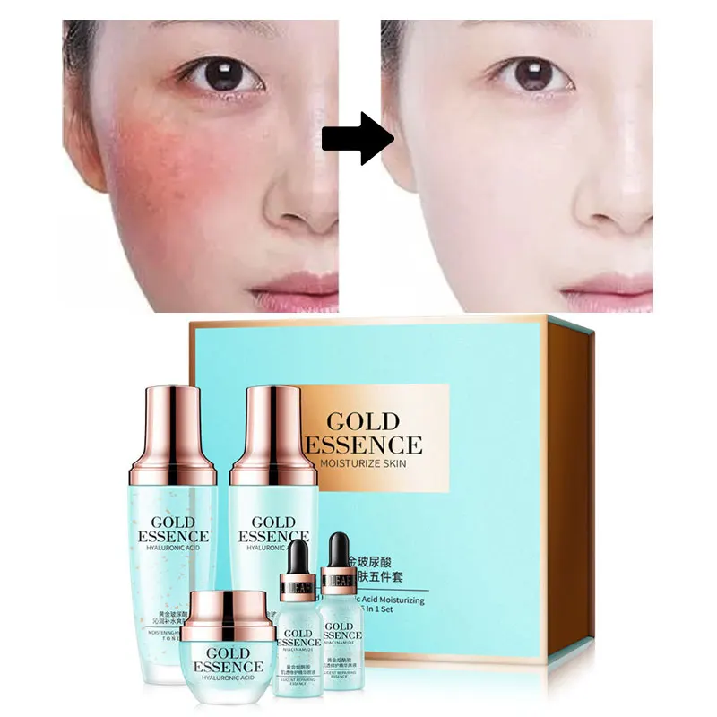 

Золотая гиалуроновая кислота, увлажняющая кожа, набор из пяти предметов, укрепляющая кожу, против морщин, против старения, глубокое увлажне...