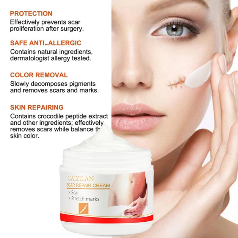 30g Acne Scar Stretch Marks Repair Cream Removal Spots Blackhead Whitening Skin For Scald Marks Skin Smoothing Scar Repair Cream