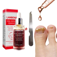 onychomycosis nail fungal treatment feet care essence nail foot whitening toe nail fungus removal gel anti infection paronychia