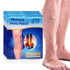 ZB китайская травяная медицина Штукатурка варикозное расширение вен лечение патч лечение СПАЙДЕР варикоза ангиит удаление фалбита ног вен