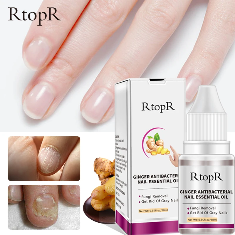 

RtopR Nail Fungal Treatment Serum Anti-Fungal Onychomycosis Paronychia Feet Care Essence Nail Foot Toe Nail Fungus Removal Gel