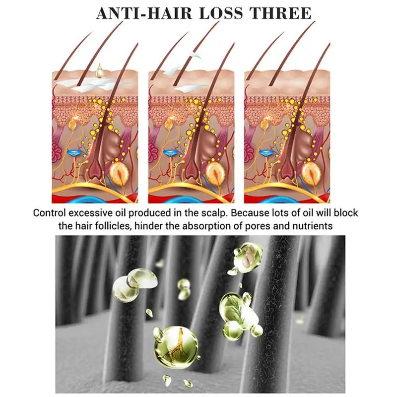 

20ml Powerful Hair Growth Serum Prevent Hair Loss Essential Oil Promote Hair Growth Color Protection After Dyeing Essence Care