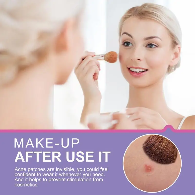 

ELAIMEI 24pcs Skin Tag Remover Pimple Master Patch Treatment Invisible Acne Stickers Patch Skin Acne Concealer Face Makeup Tools