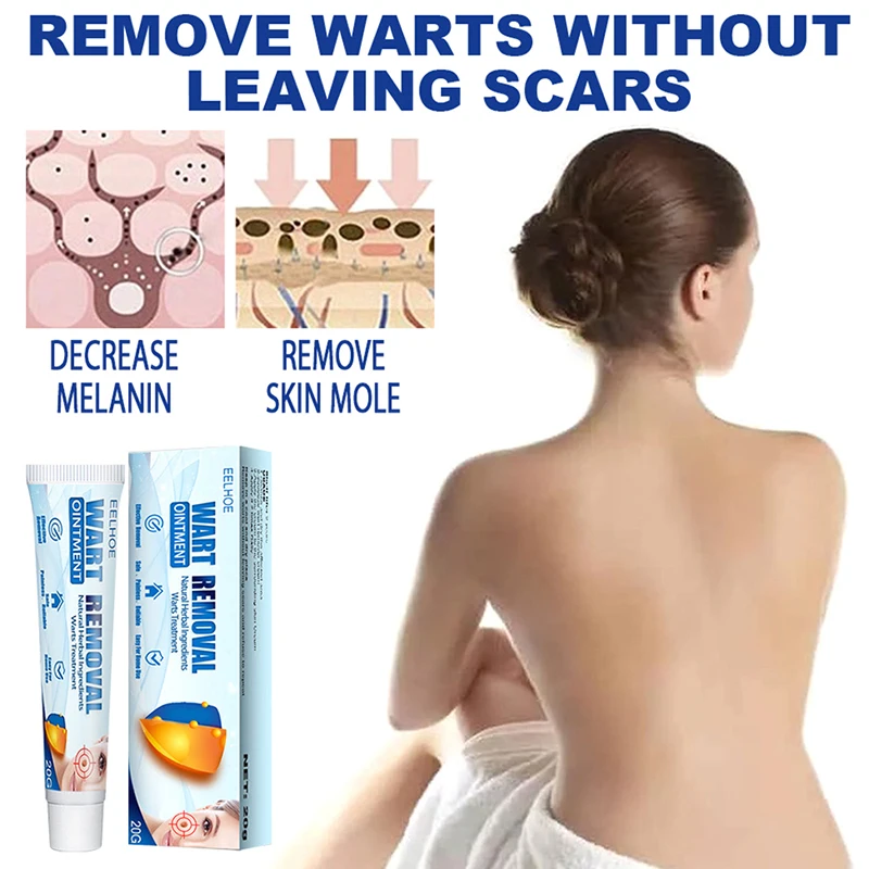 2Pcs Warts Remover Ointment Wart Treatment Cream Skin Tag Herbal | Красота и здоровье