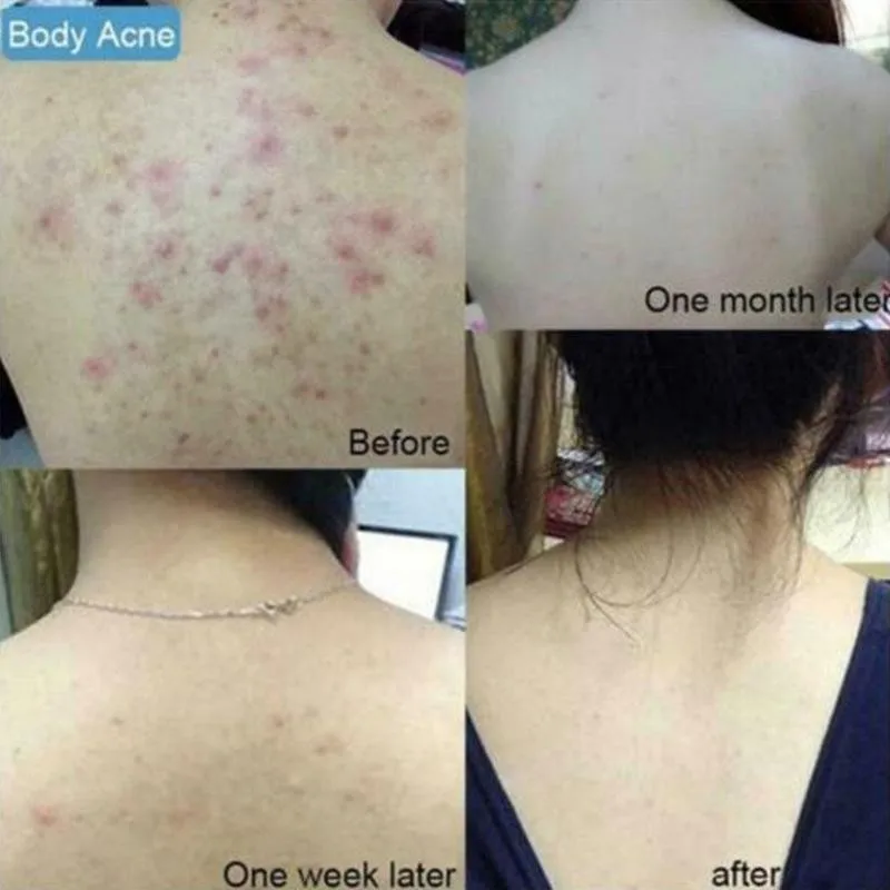 

Natural Sea Salt Essential Oil Soap Whitening Handmade Goat Milk Soap For Remove Skin Acne Mite Removal Deep Cleansing Skin Care