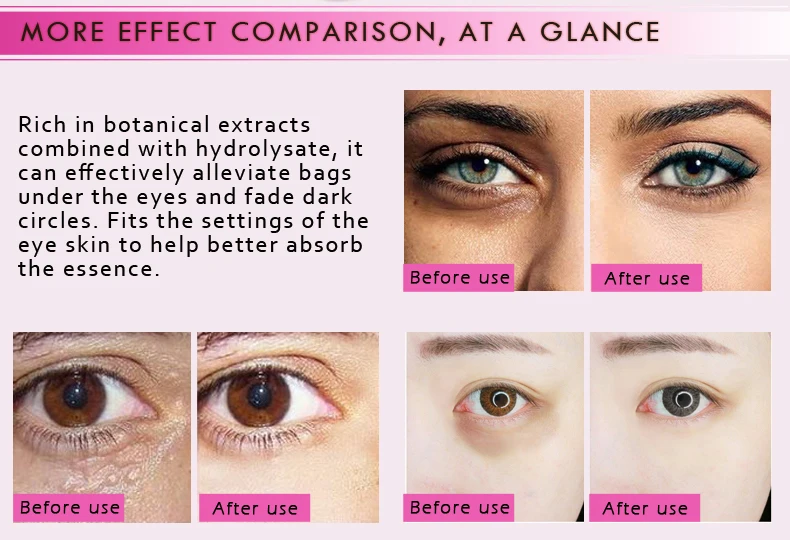 10 упаковок увлажняющая маска для глаз с витамином С манго против морщин