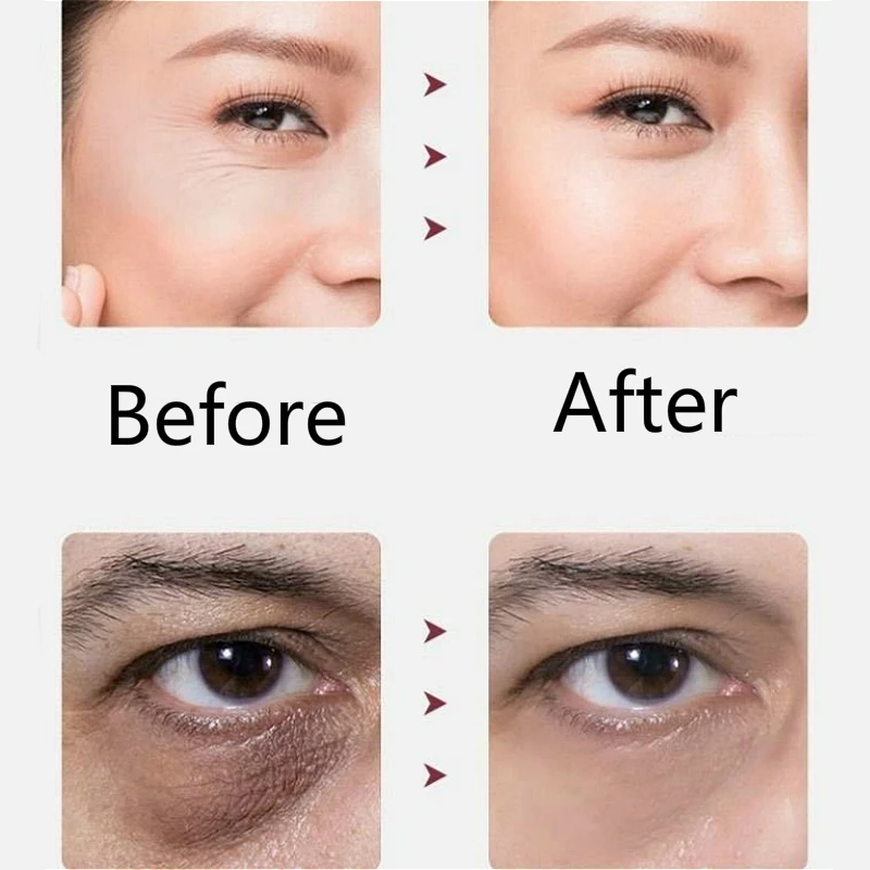 РЧ инструмент для красоты светодиодный фотонный светильник терапевтический