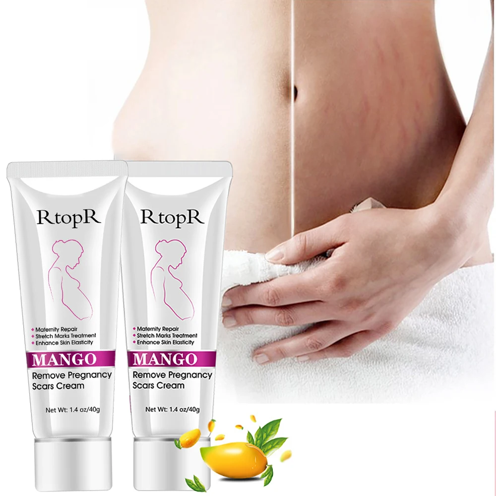 Treatment Stretch Mark Cream Fade Obesity Lines Promote Cell Regeneration Enhance Skin Elasticity Pregnant Women Postpartum Care | Красота и
