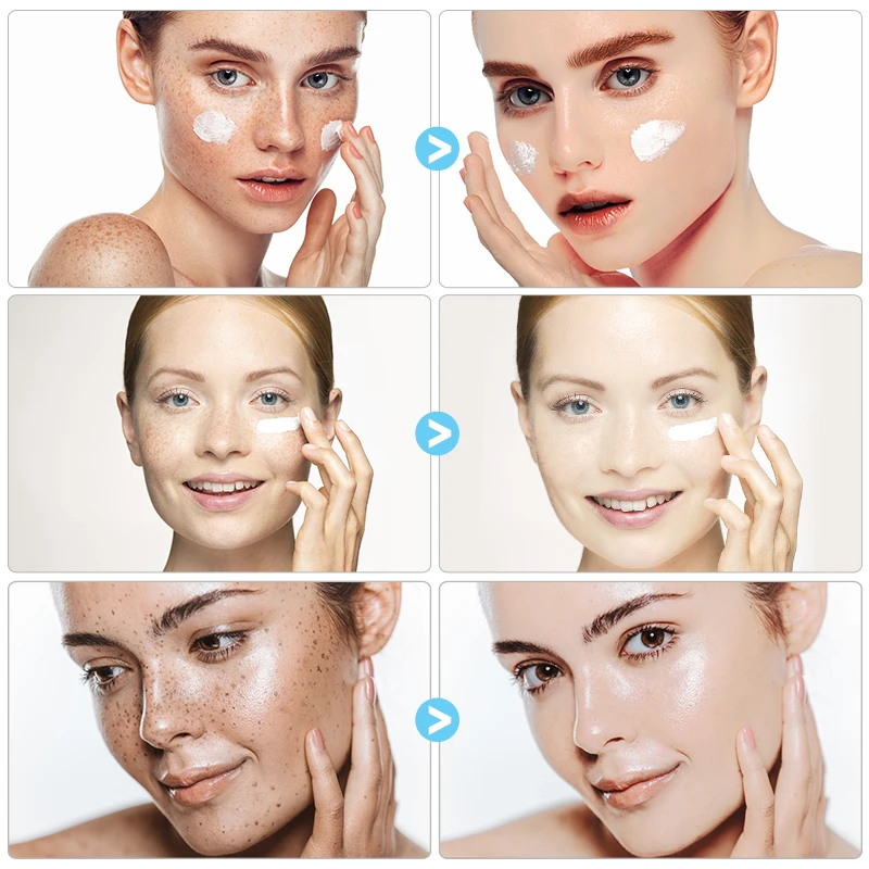 Dimollaure Strong Whitening Cream + Hyaluronic Acid Serum Moisturizing Remove Freckle Melasma Pigment Melanin Sunburn Face Care | Красота и