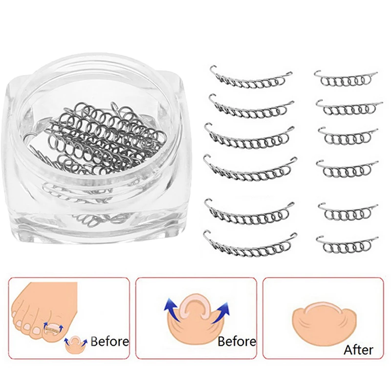 Новинка 12 шт. вросший Носок проволочный фиксатор для коррекции ногтей педикюр