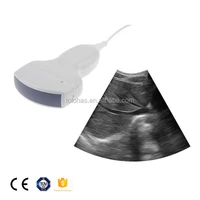 lhup20v handheld vet ultrasonic machine usb convex array ultrasound scanner veterinary ultrasonic probe