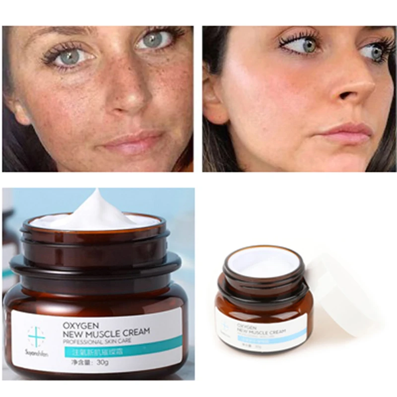 

Strong Removal Melasma Whitening Cream Freckle Speckle Spots Melanin Pigment primer makeup