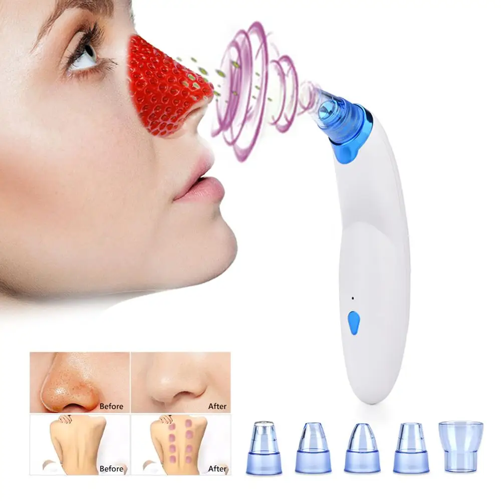 Средство для удаления угрей электрическое USB перезаряжаемое вакуумное очищающее