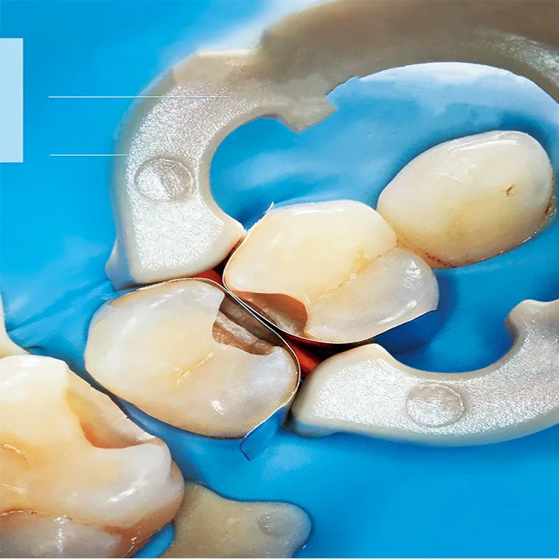 Полный комплект стоматологическая матрица секционные Контурные матрицы + 120 шт.