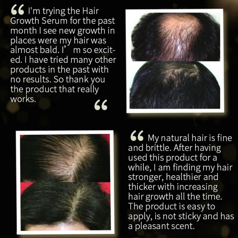 

30ml Hair Oil Natural Organic Black Rice Anti-hair Loss Dry Hair Serum Conditioner Black Seed Hair Essence Spray