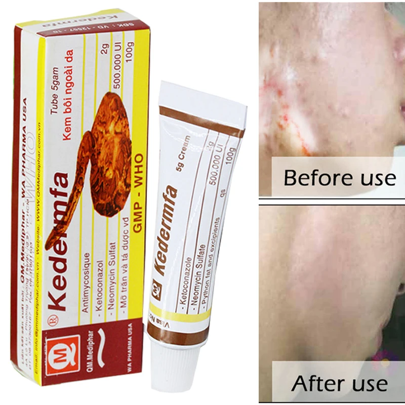 

Vietnam Remove Scar Cream Remove Acne Spots Remove Striae Gravidarum Pigmentation Corrector Anti-Aging Moisturizing 5ml