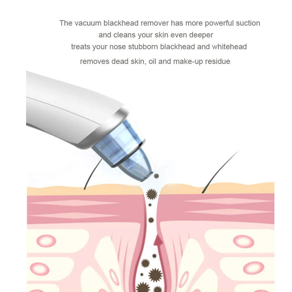 Удаляющий Черный инструмент скруббер косметический аппарат для очистки акне