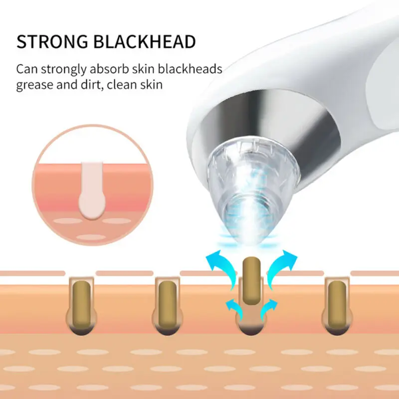 

Blackhead Vacuum Acne Cleaner Electric Blackhead Remover Pore Vacuum Suction Acne Face Skin Care Cleaner Tools