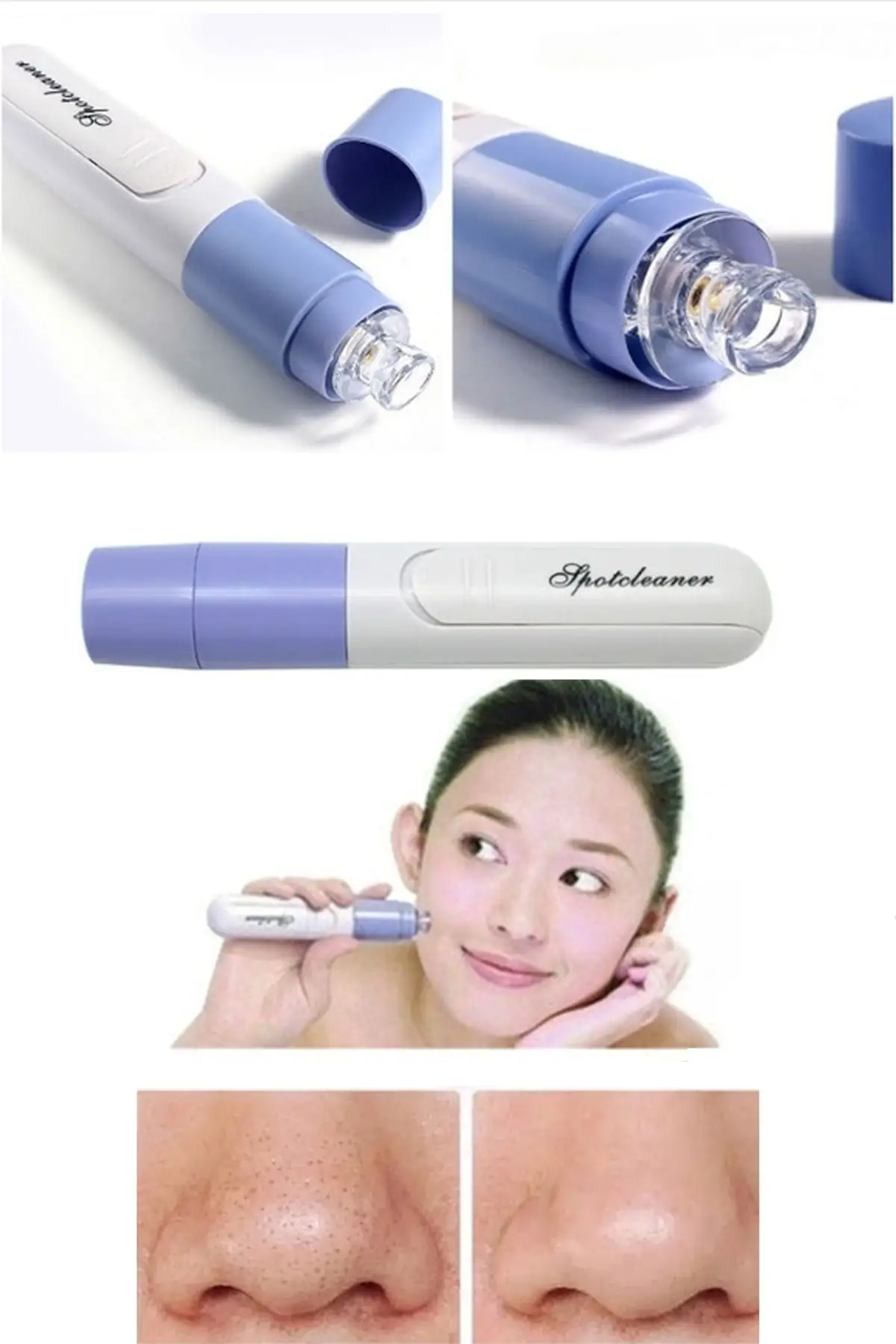 

Вакуумный очиститель пор для лица, устройство для очистки черных точек