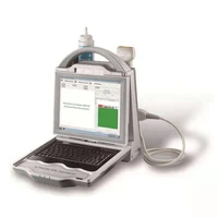 factory price medical ultrasonic bone density tester ultrasound machine