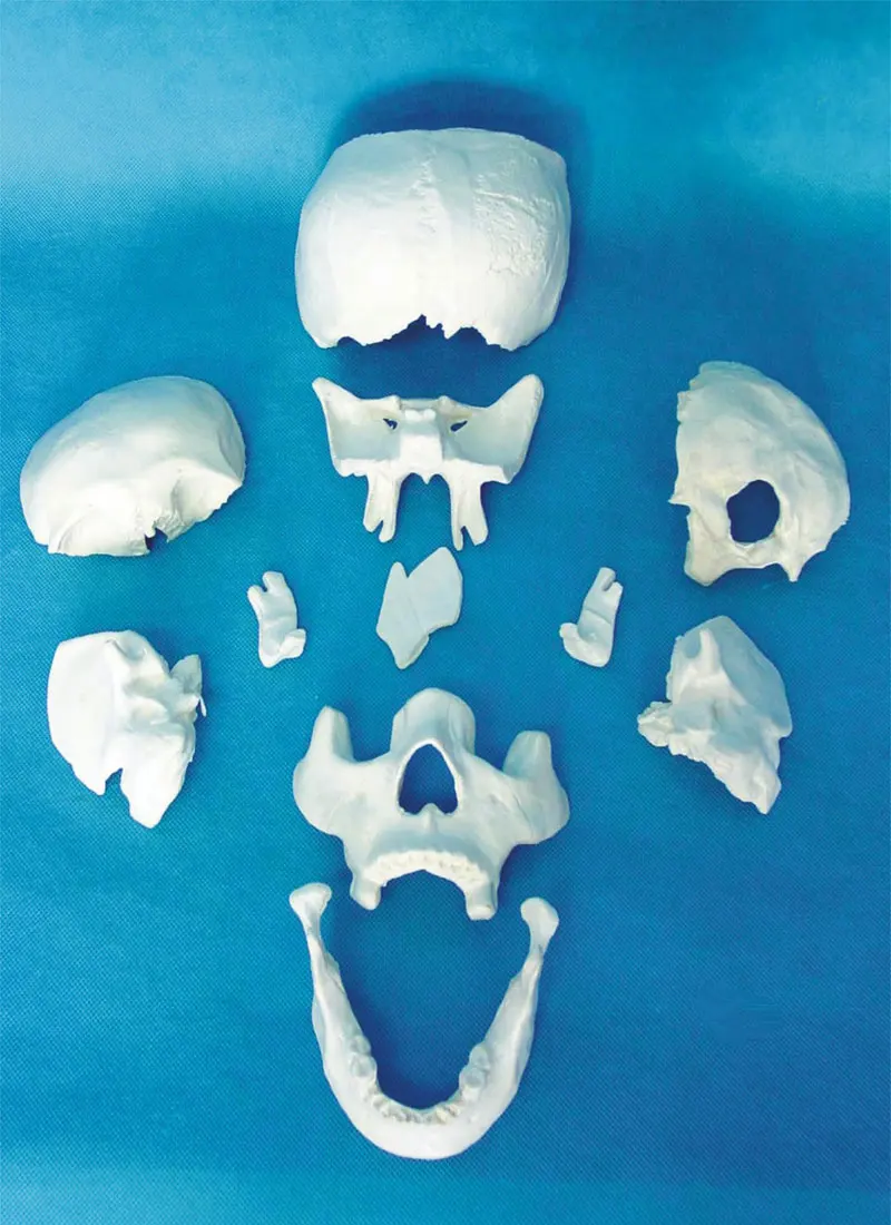 

11pcs HOT Advanced Scattered Bones of Skull Model, Skull Dispersive Bone Model ,Skull Model Medical Teaching Skeleton Models