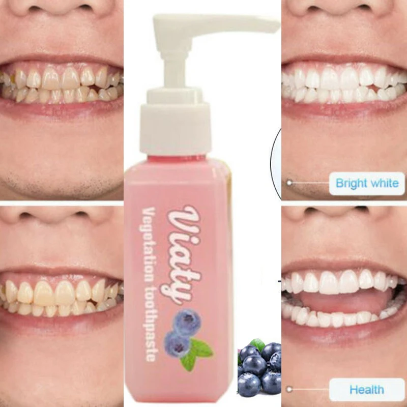 

30ML Pressed Toothpaste Stain Removal Whitening Blueberry Toothpaste Fight Bleeding Gums Teeth Whitening Tool pasta de dientes