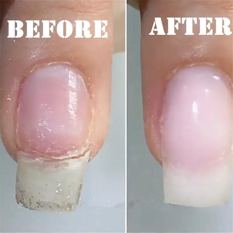 Ремонт ногтей из стекловолокна шелковая пленка самоклеющаяся Анти повреждение