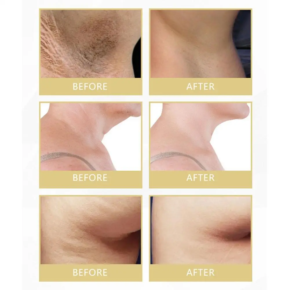 

Auquest body whitening cream armpits armpits whitening cream white skin moisturizing private 50ml legs carekorea V2I8