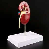 life size human kidney diseased model anatomical anatomy diseased pathological stone organ teaching supplies 634b