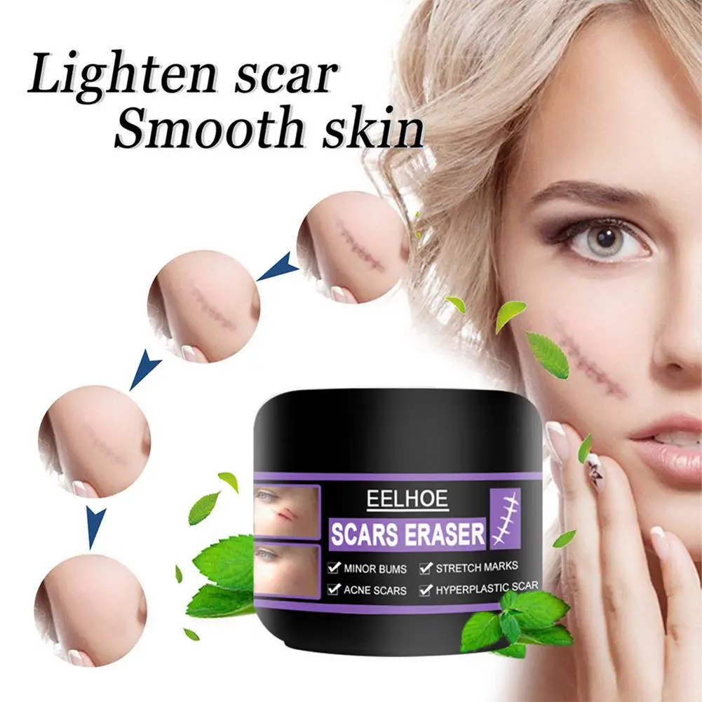 

Scar Removal Cream Effective Scar Remover Gel For Acne Spots No Trace Repair Repair Cream Can Smooth Texture Redness Or Itching