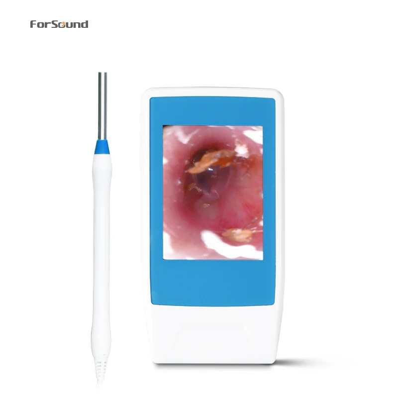 

Popular HD Video Digital Otoscope portable otoscope video camera multifunctional ENT endoscope