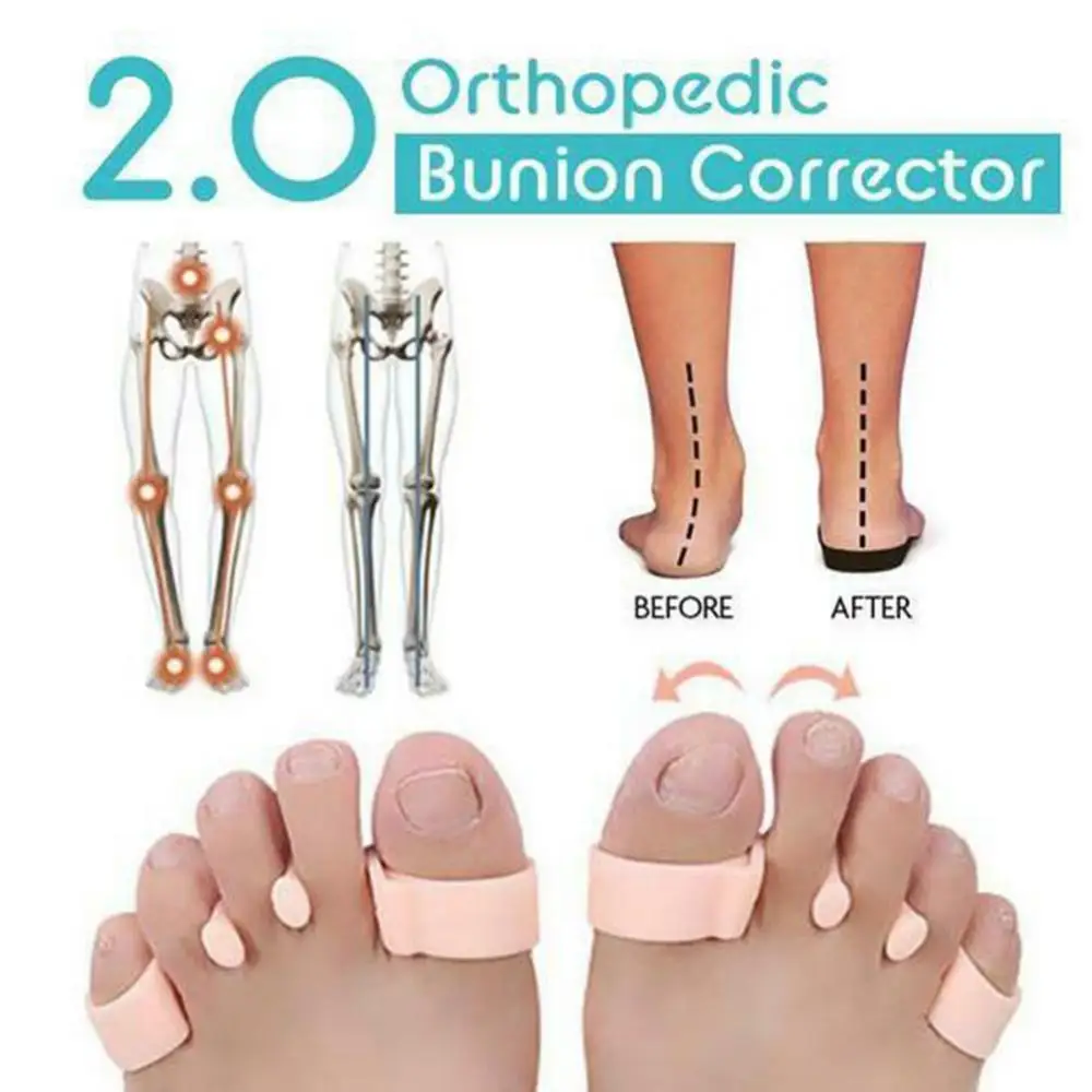 

Toe Separator Correction Hallux Valgus Corrector Silicone Orthopedic Hammer Separator Straightener Spreader Foot Care Tool