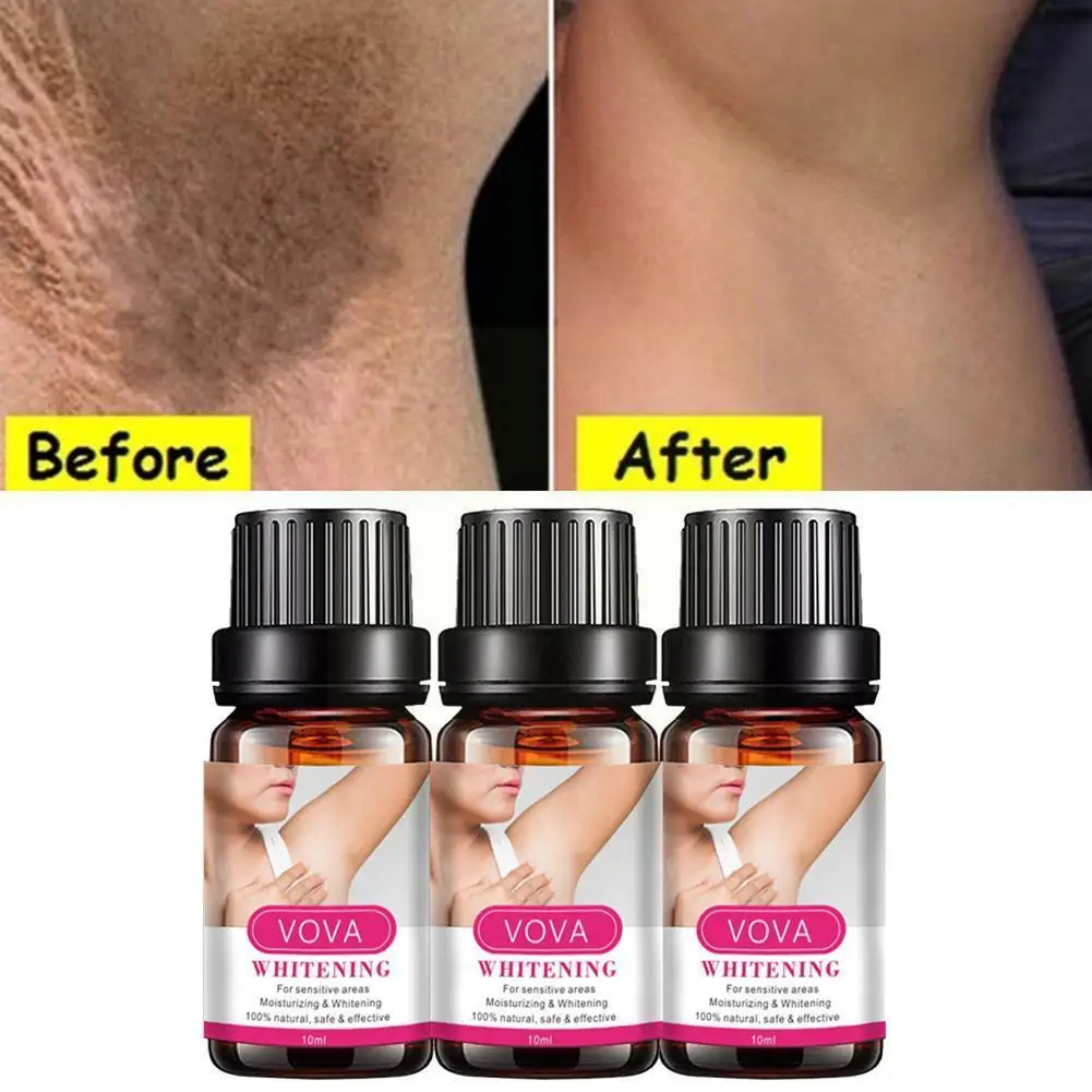 

10ml Armpit Whitening Oil Underarm Dark Skin Legs Knees Whitening Oils Creams Moisturizing Essential Body Body Intimate D3G6