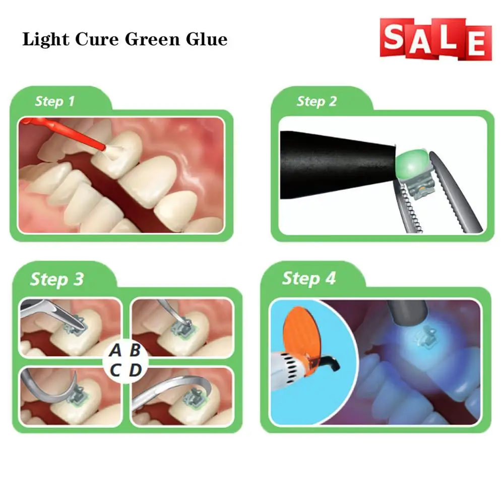 Стоматологический ортодонтический клей Cesoon светильник-зеленый система прямого