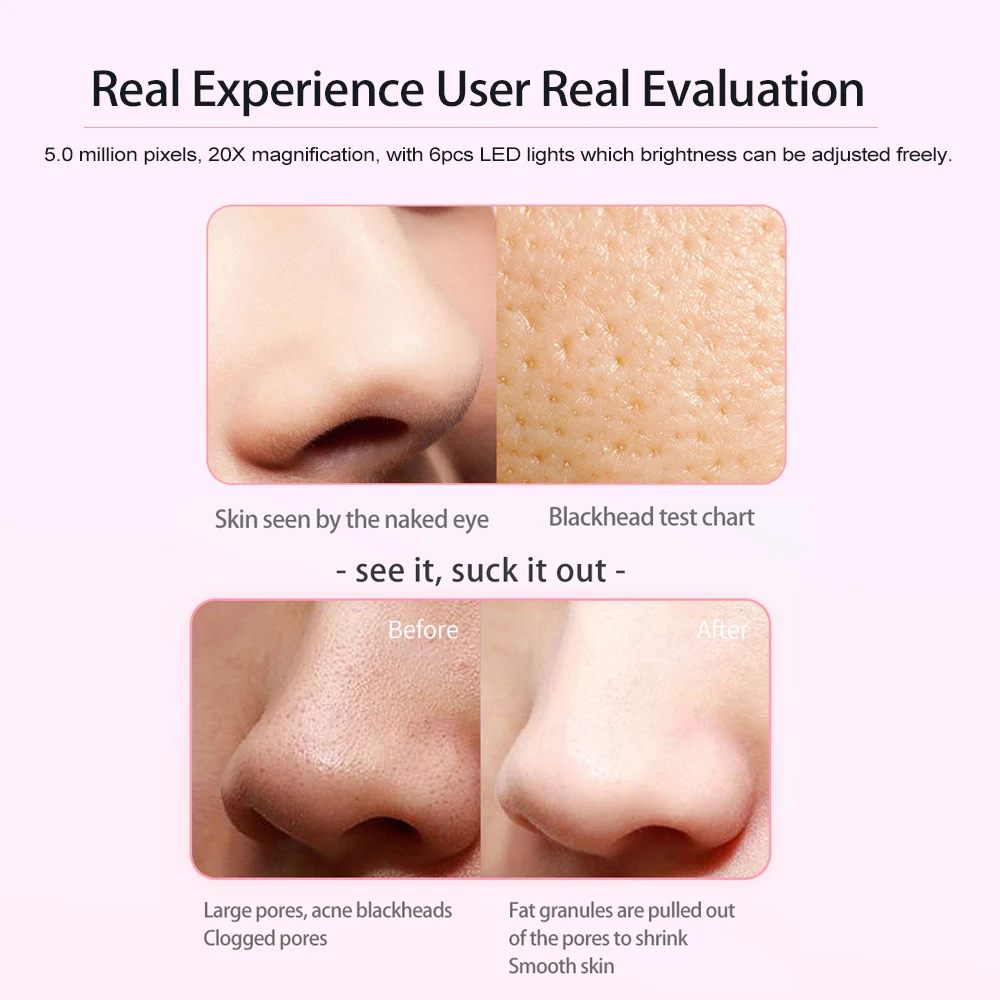 Электрический инструмент для удаления чёрных точек ЖК дисплей Дисплей WI FI