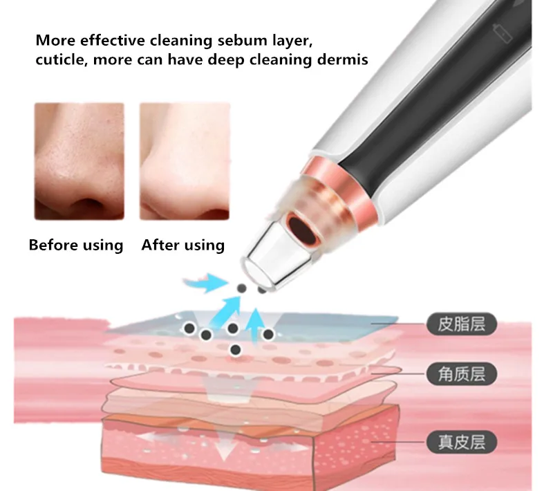 Средство для удаления угрей очищающее средство лица глубокое Удаление пор