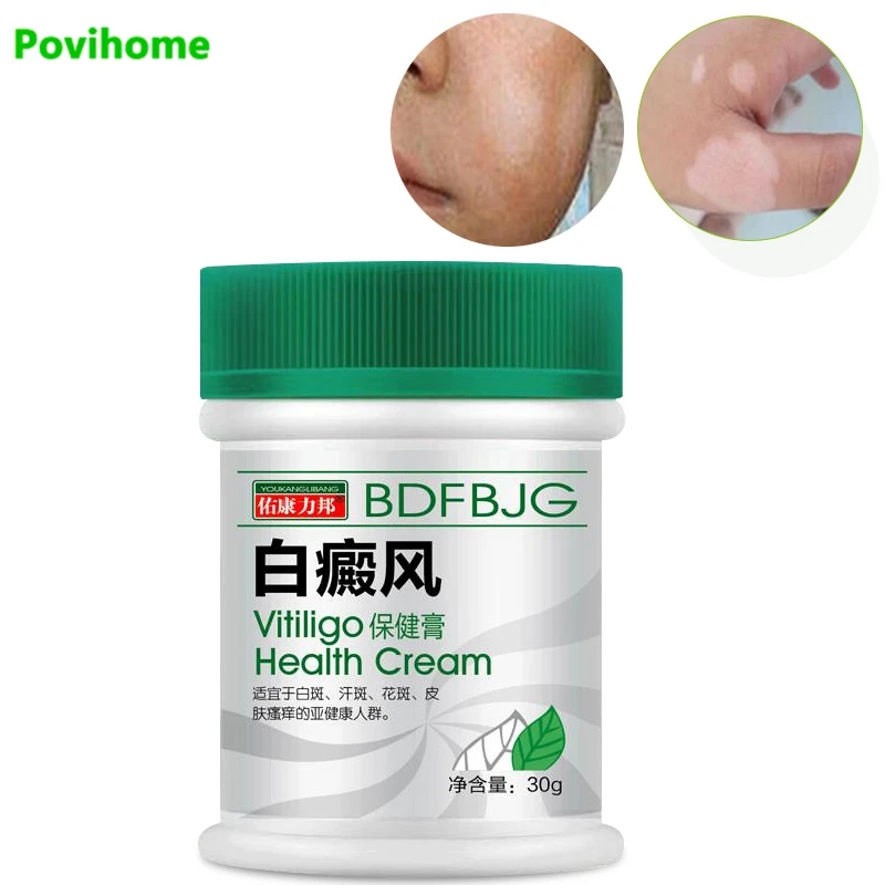 

20&30G VitiligoTreament Cream Antibacterial Cream Psoriasis Localized Vitiligo Ointment White Spot Mycosis Leukoplakia Treat