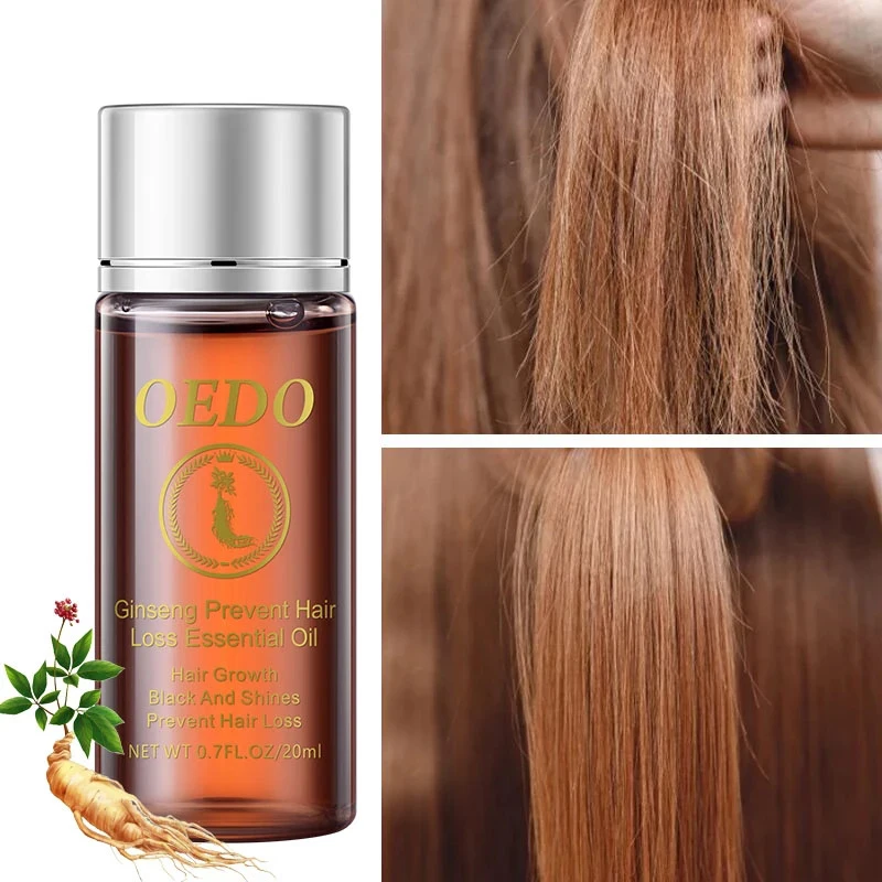 20 мл эфирное масло женьшеня для предотвращения выпадения волос стимулирует рост