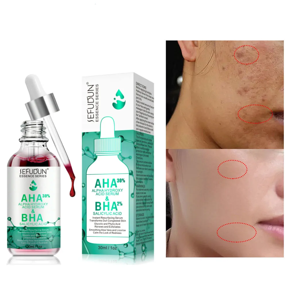 

30% Fruit Acid Serum Cleansing Pore Face Care Essence Remove Acne Marks Blackhead Oil Control Brighten Exfoliating Skin Care