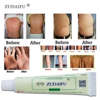 Dropshipping 50PCS Zudaifu Skin Psoriasis Cream Dermatitis Eczematoid Eczema Ointment Treatment Psoriasis Cream Skin Care Cream