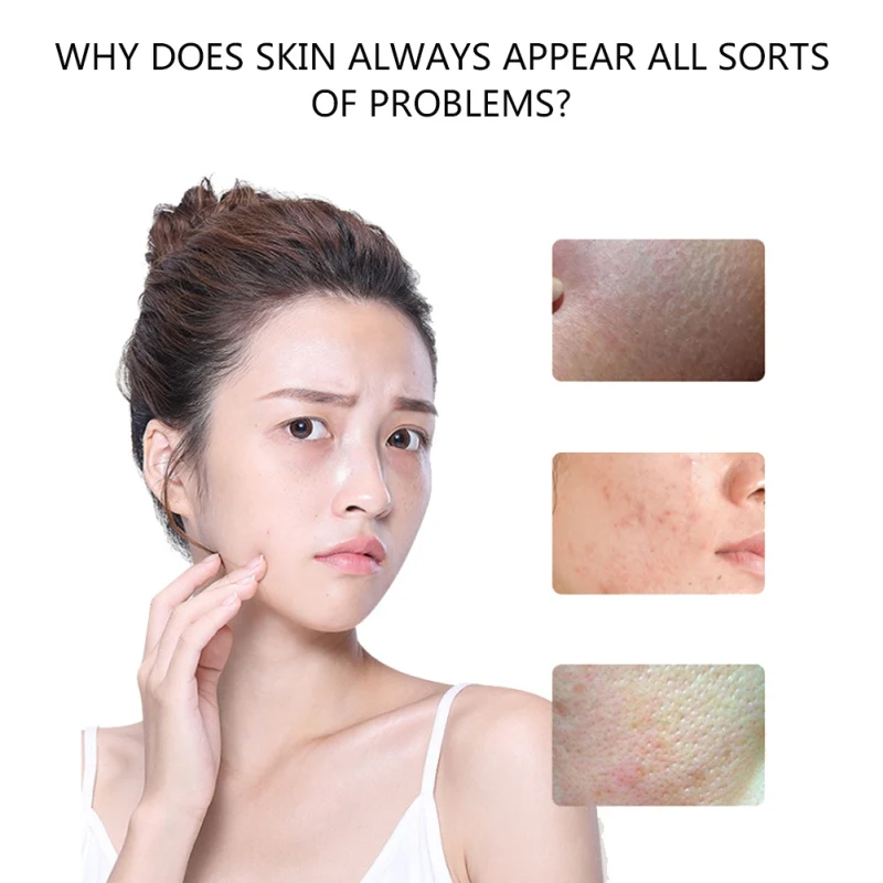 Уход за лицом Витамин Е эмульсия увлажняющий крем для лица анти средство против