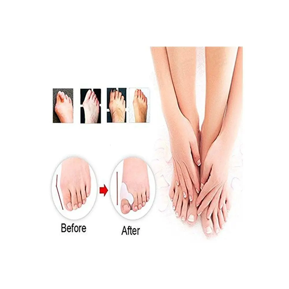 Hallux ноги сепаратор гель корректор бурсита большого пальца стопы щит ортопедические подтяжки корректная Ортопедическая подушка большого пальца ноги