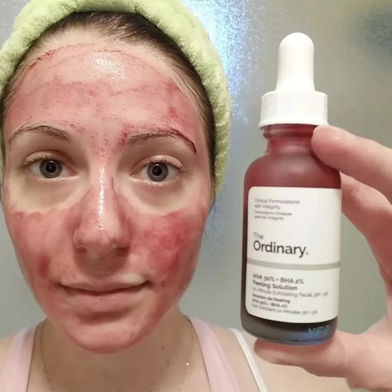 

Ordinary Face Makeup Peeling Solution AHA 30% + BHA 2% Acne Removing Serum Repair Hyaluronic Acid Hydrating Face Skin Care 30ml