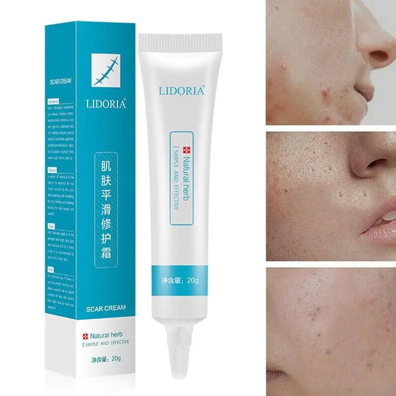 Травяной шрамовый знак удаление кожи тела кремовый дефект уход восстановление