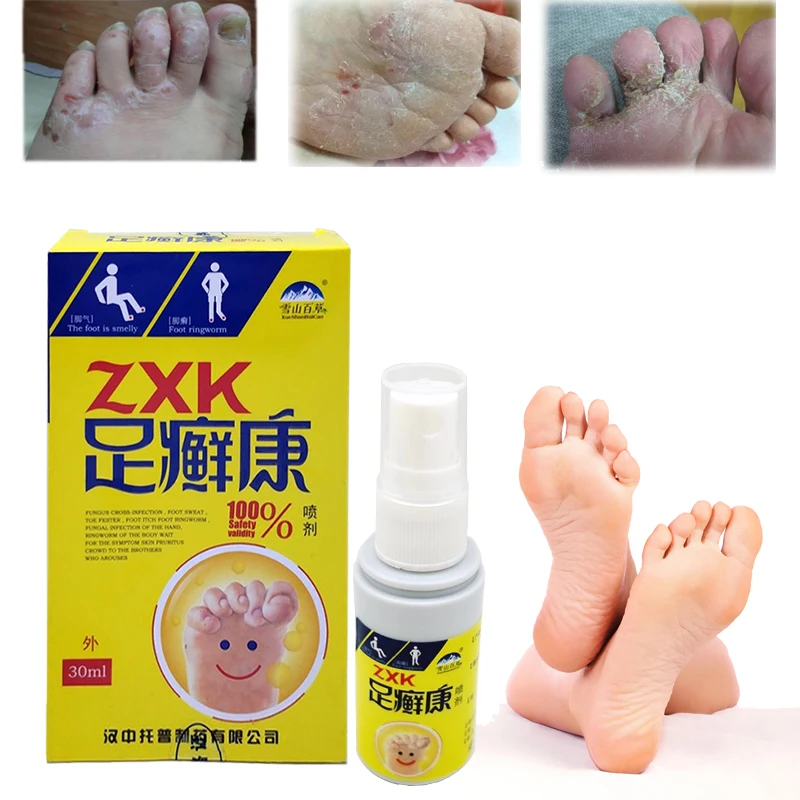 Foot & Shoe Deodorant Spray Feet Care Anti Itch Sweat Odor Feet Athletes Foot Liquid Anti-fungi Shoe Sock Feet Care