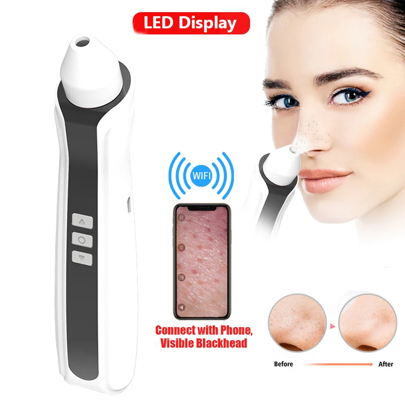 Визуальный пылесос для удаления черных точек со встроенным микроскопом HD-камера