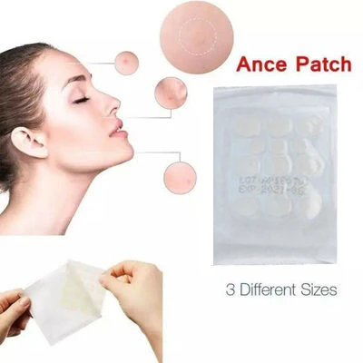 Патчи от акне наклейки для Набор 15 наклеек на штуку лечение прыщей мастер патч